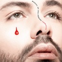 Manual de una Pérdida