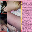 Date (You Got Blisters)