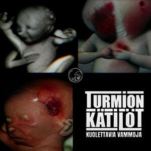 Turmion Kätilöt 15